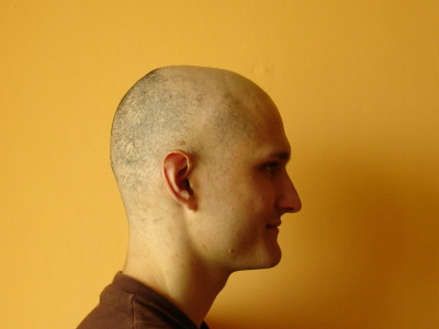 Chemo 08