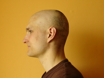 Chemo 09